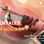 Implantes estrategicos en 24 horas