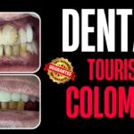 Dental tourism in colombia