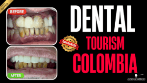 Dental tourism in colombia