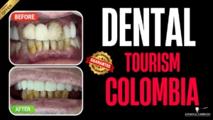 Dental tourism in Colombia