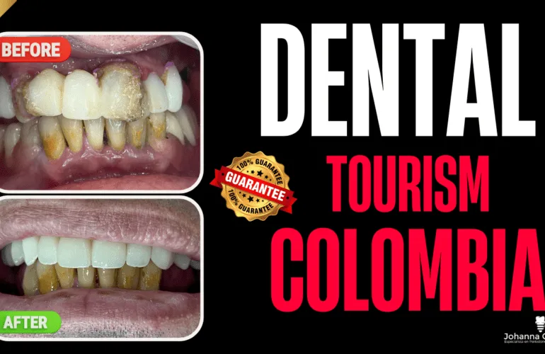 Dental tourism in colombia