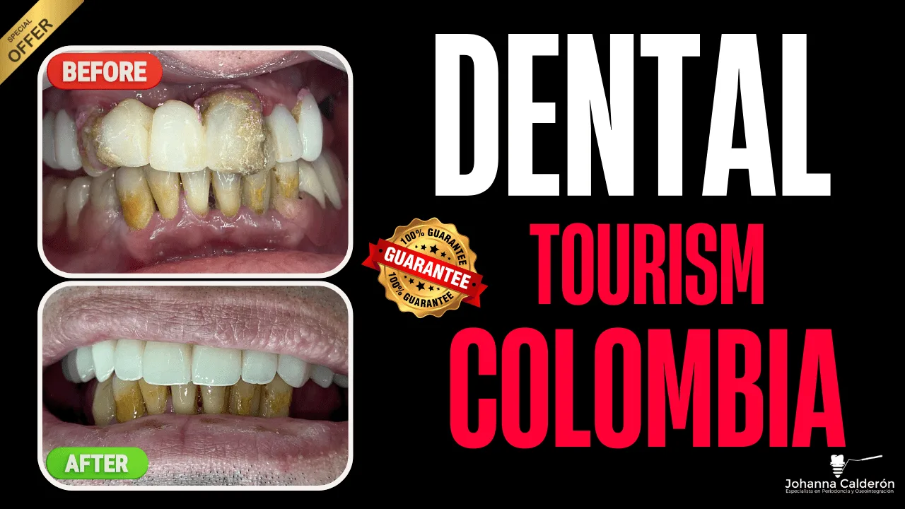 Dental tourism in Colombia