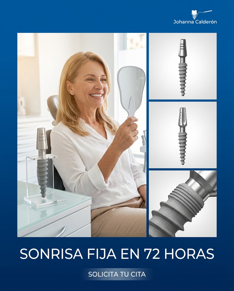 Implantes dentales