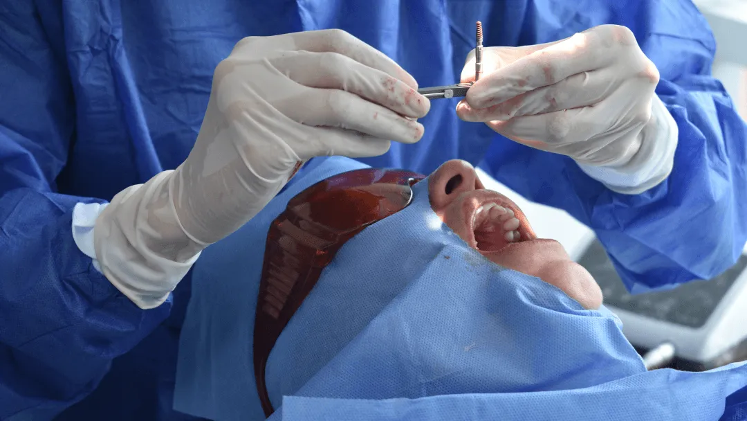 Implantes dentales