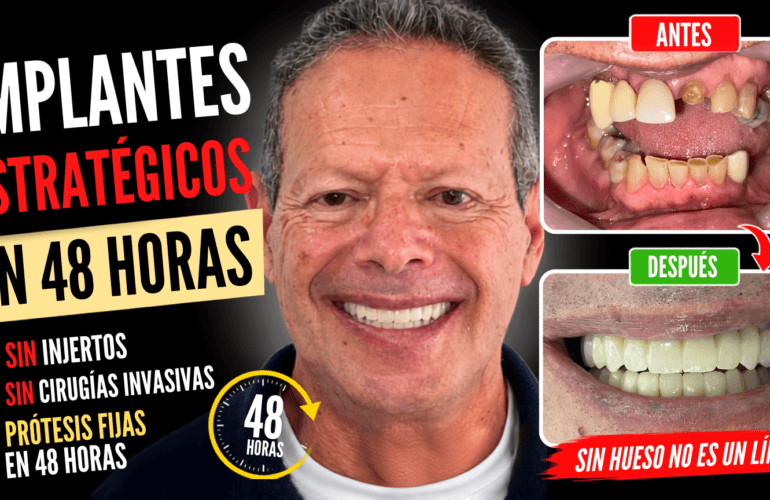Implantes estrategicos en Colombia