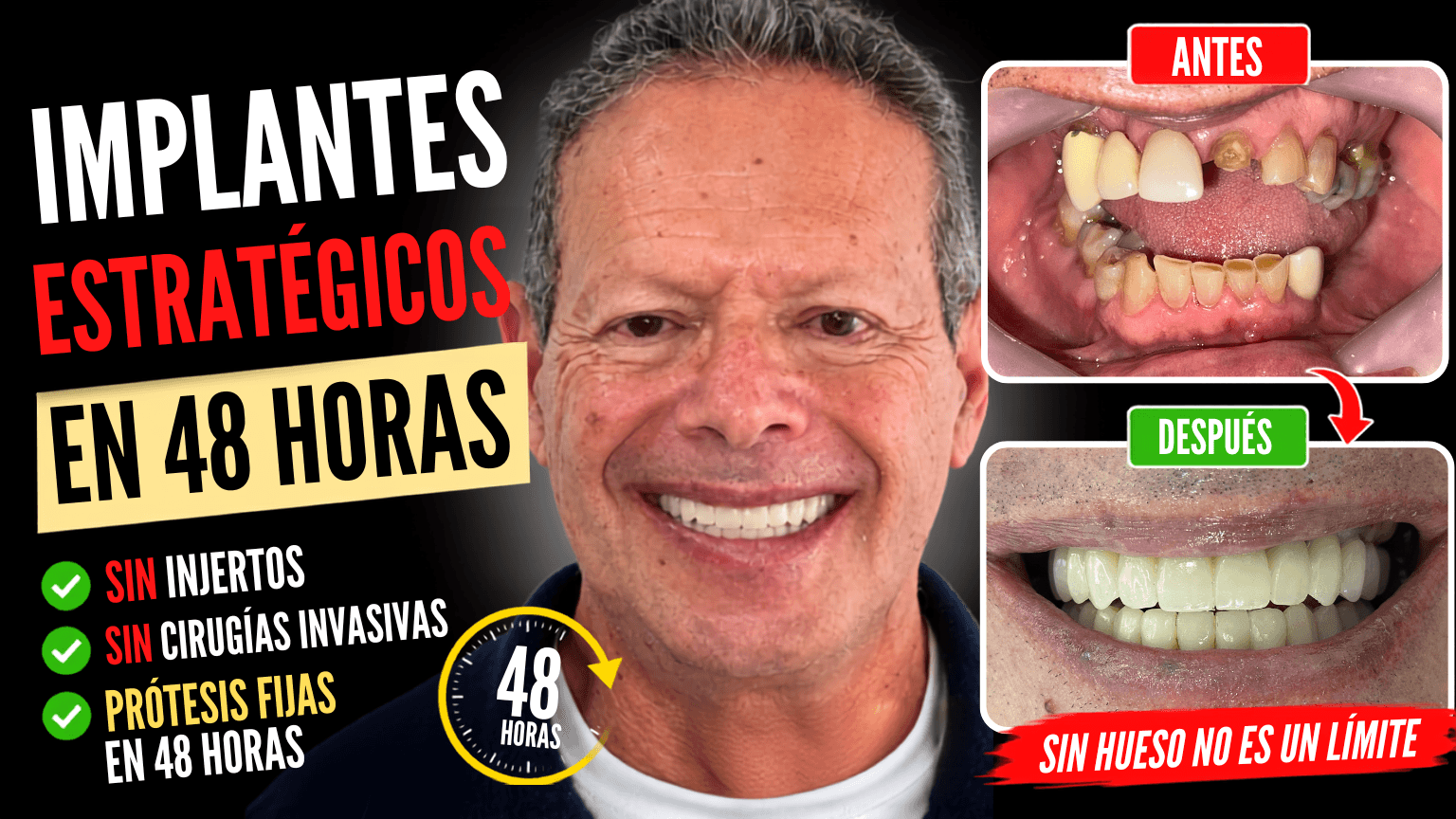 Implantes estrategicos en Colombia