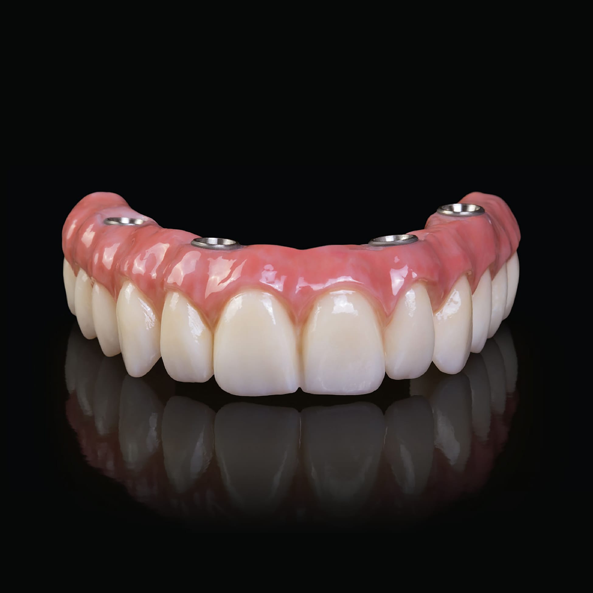Vista frontal de una prótesis fija All-on-4 de zirconio